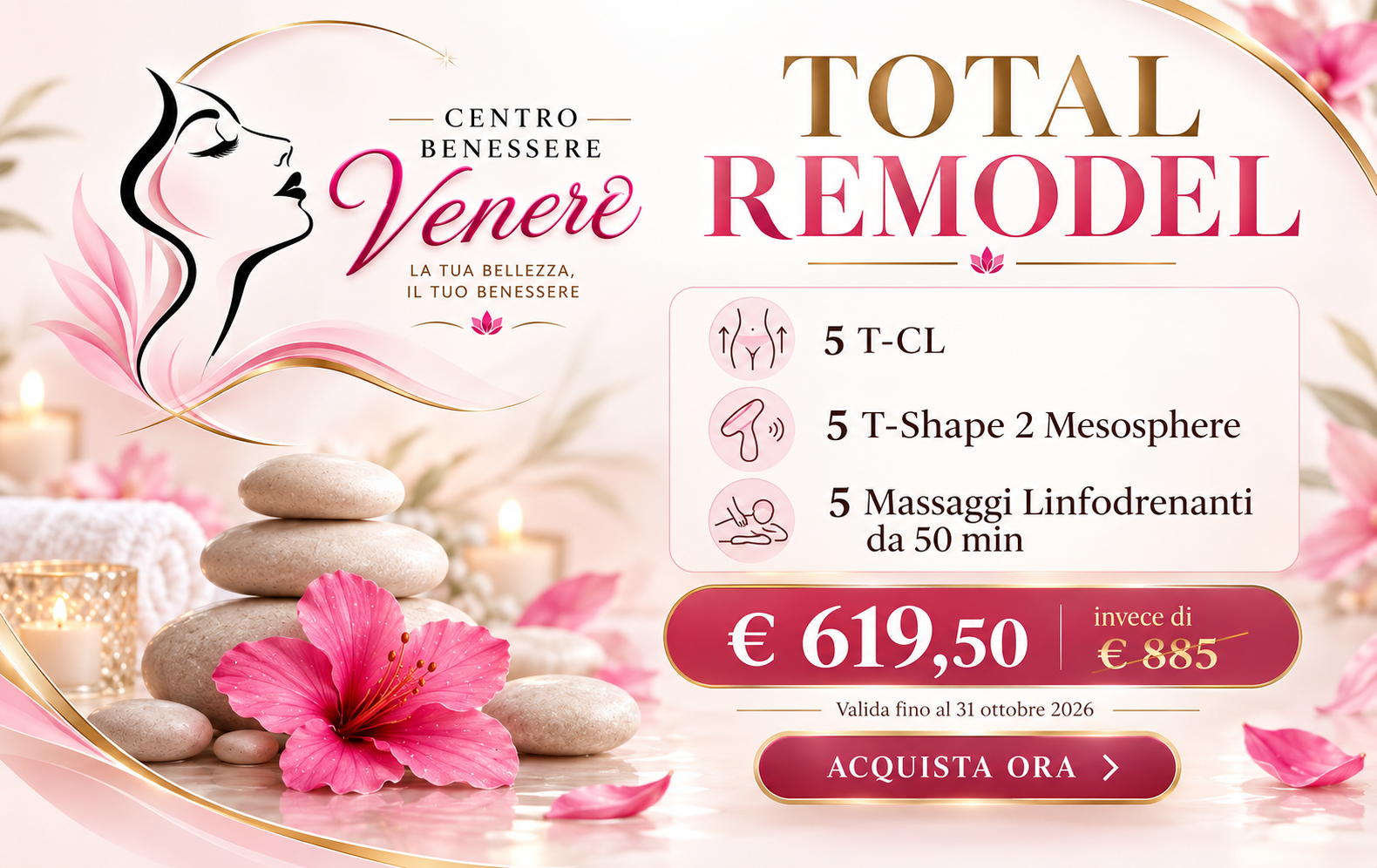 total remodel